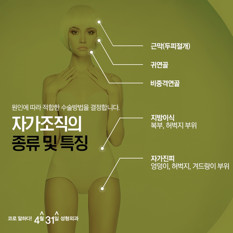 자가조직코성형 4월31일성형외과에서 자연스럽게! 관련 이미지 4