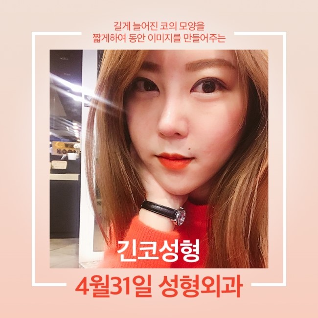 긴코성형후기 4월31일 성형외과만의 특별함. 관련 이미지 1