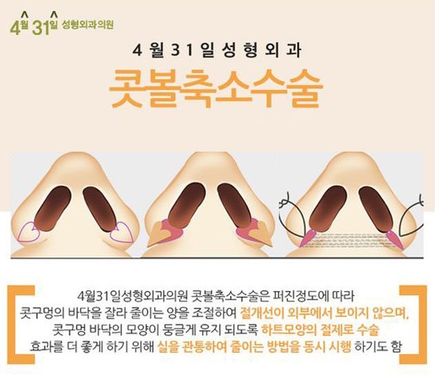 넓은코성형 예쁘게 4월31일성형외과 관련 이미지 2