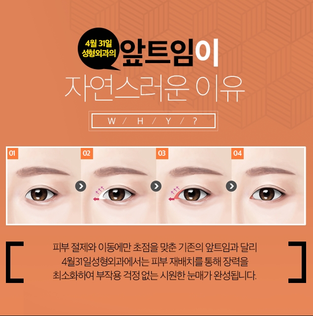 앞트임잘하는병원 자연스러운 변화를 위해 관련 이미지 3