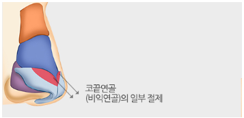 [코성형] 밸런스에 맞는 콧대길이 교정 관련 이미지 5