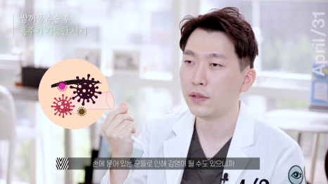 [Eye Surgery] Getting Double Eyelid Surgery Quickly and Discreetly for Vacation! image 11