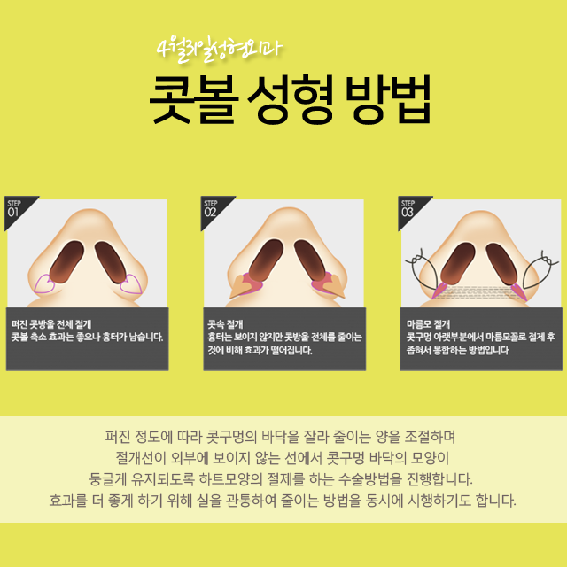 무흉콧볼축소 4월31일성형외과와 함께 관련 이미지 2