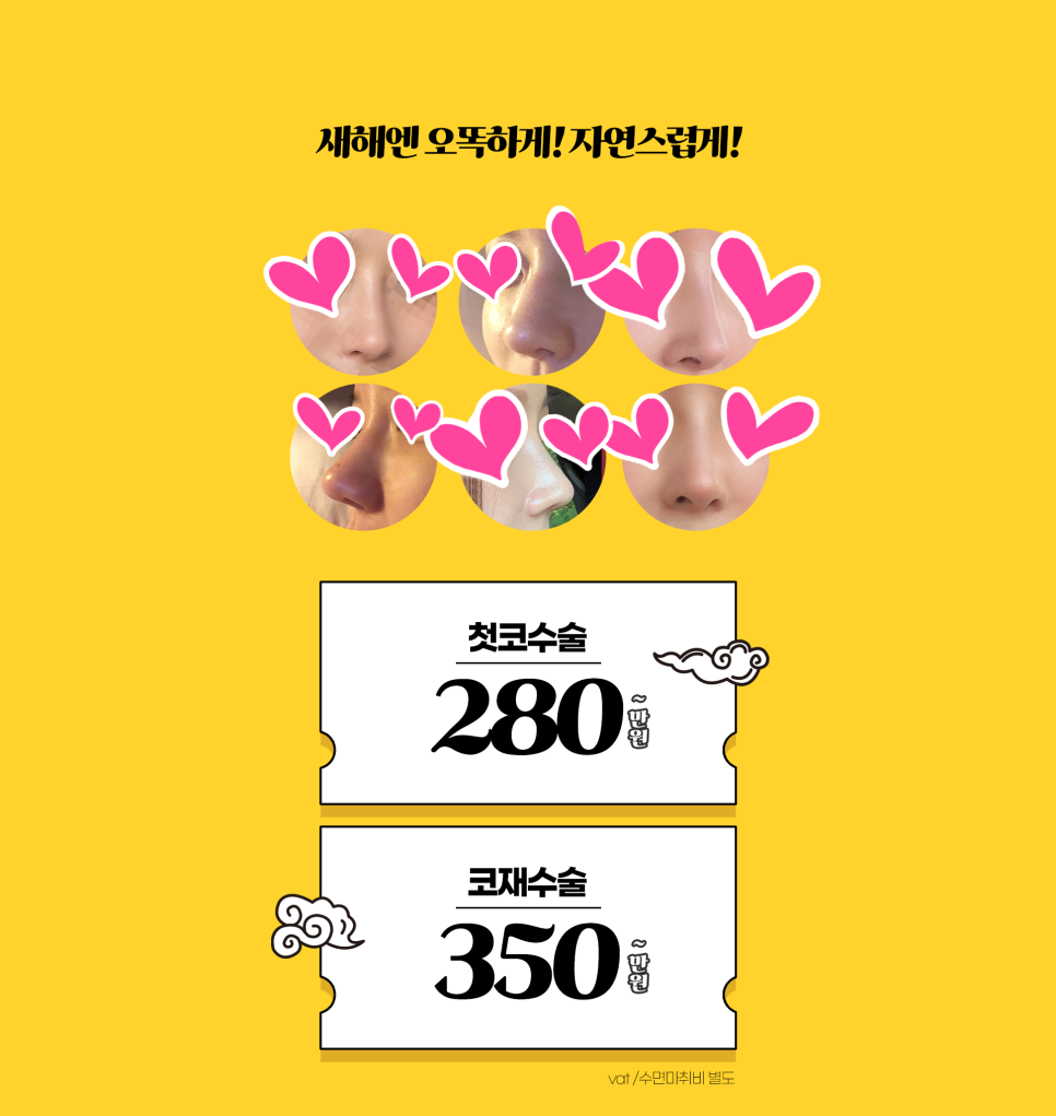 4월31일성형외과 새해맞이 이벤트<한달간 3D-CT촬영비 FREE> 관련 이미지 2