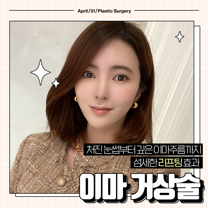 [Facelift Surgery] Endoscopic Forehead Lift or Brow Lift: Which Case Am I? image 2