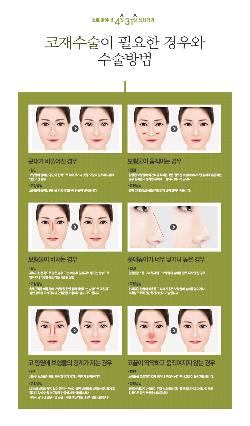 If You Want to Correct Your Nose Completely, Down to the Tip, with Revision Rhinoplasty image 3
