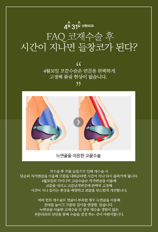 구축코재수술후기 4월31일성형외과에서 확인 관련 이미지 3