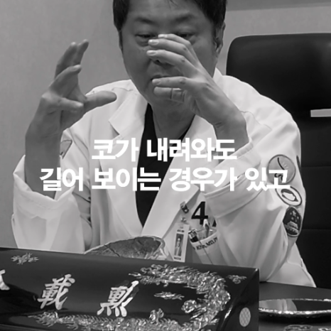 [4월31일성형외과] 콧구멍이 안보이면 중안부가 길어 보일까? 관련 이미지 4