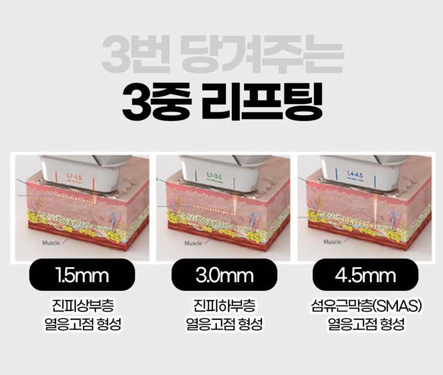 [April 31 Petit Center] The Ultimate Lifting Treatment! Tighten and Boost Firmness with Shurink + Liftera! image 4