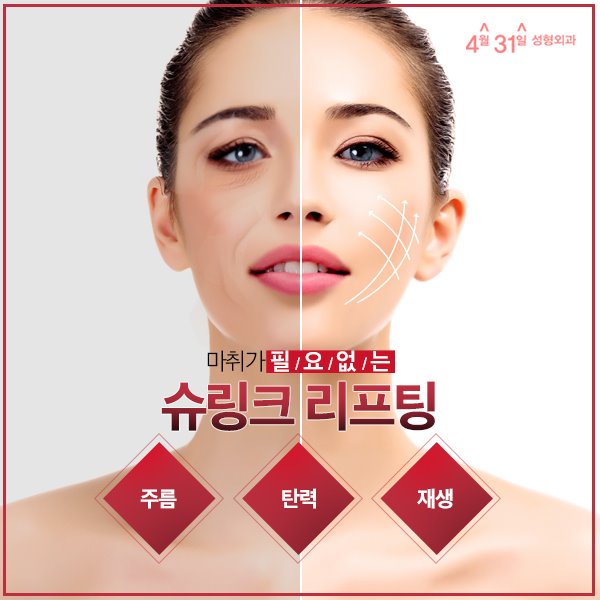 슈링크잘하는곳 4월31일성형외과 관련 이미지 1