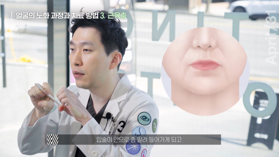 [안면거상] 노화를 되돌리는 동안성형 파헤쳐보기! 관련 이미지 8