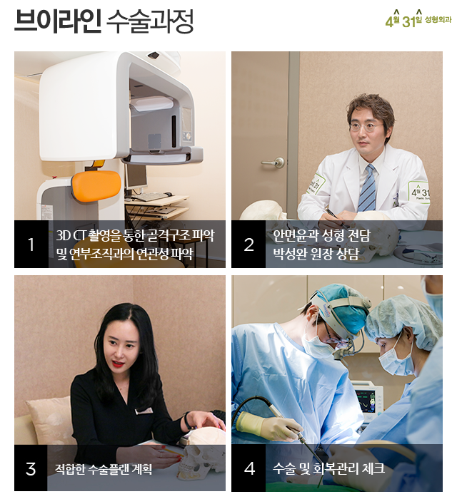 턱선성형 4월31일성형외과 브이라인수술 관련 이미지 3