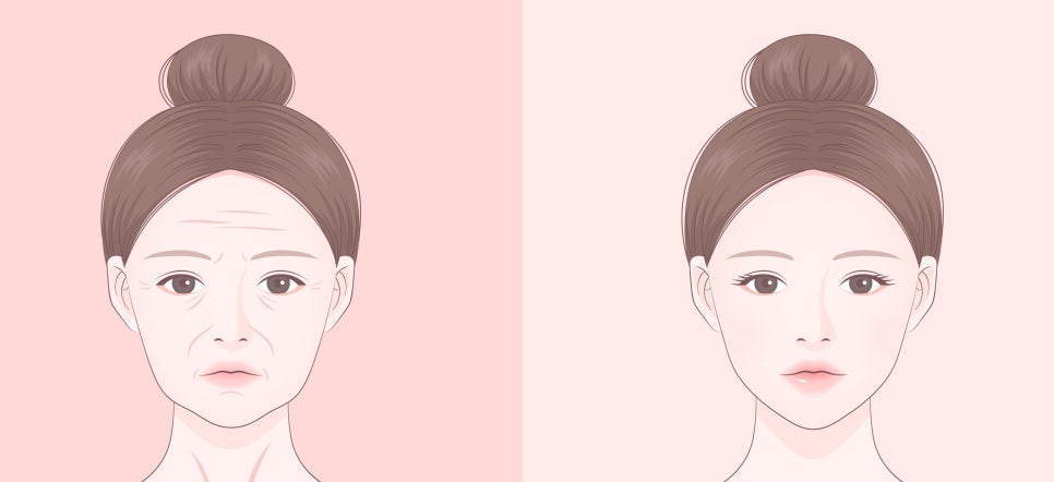 [4월31일쁘띠센터] 노안 탈출 성공 비법 (리프팅/필러/피코토닝) 관련 이미지 2