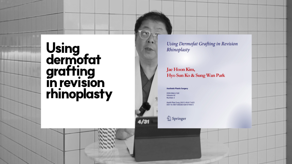 [Contracted Nose] Deep Analysis of the 5th Stage of Contracted Nose Correction / Part_04 Appropriate Grafting for the Nasal Bridge and Tip image 9