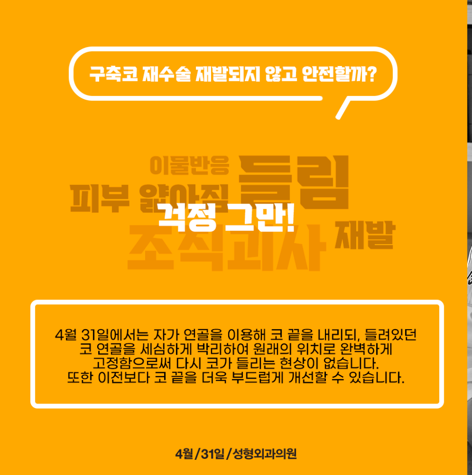 구축코재수술병원 재발위험은 낮추고 내얼굴에 맞는 코완성! 관련 이미지 3