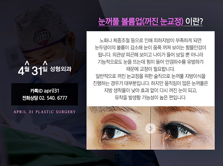 눈꺼풀볼륨업 4월31일성형외과에서 개선하자! 관련 이미지 2