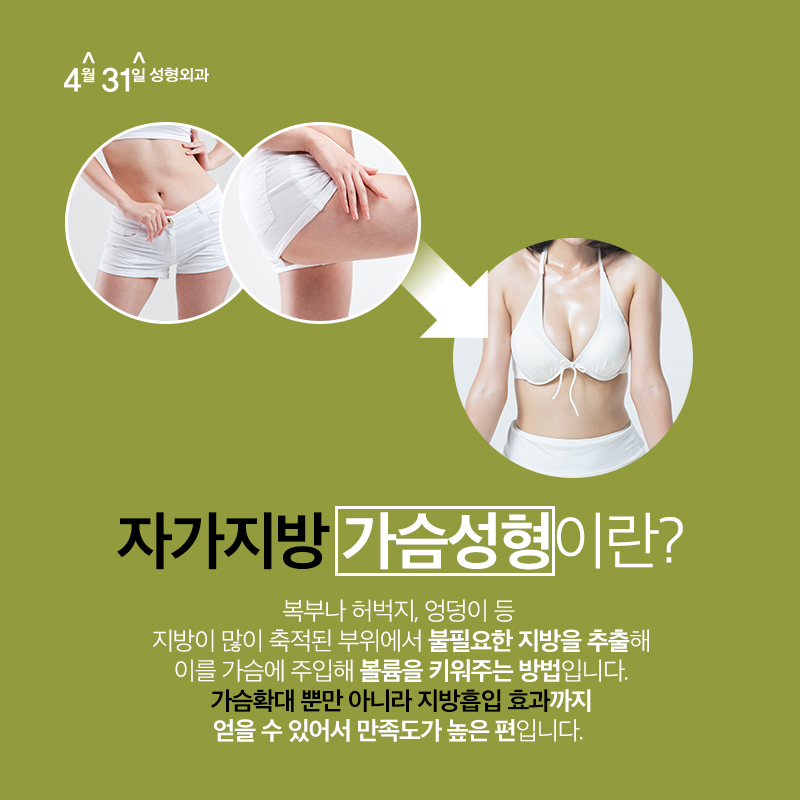 가슴자가지방이식 4월31일성형외과라면? 관련 이미지 2