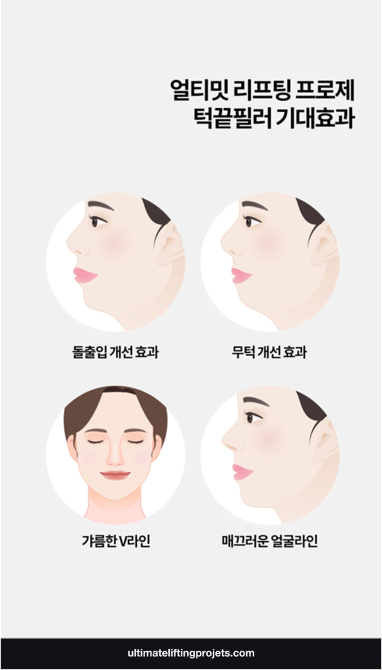 턱끝필러+턱끝보톡스(자갈턱보톡스) 2가지 시술로 효과 2배 UP! 관련 이미지 3