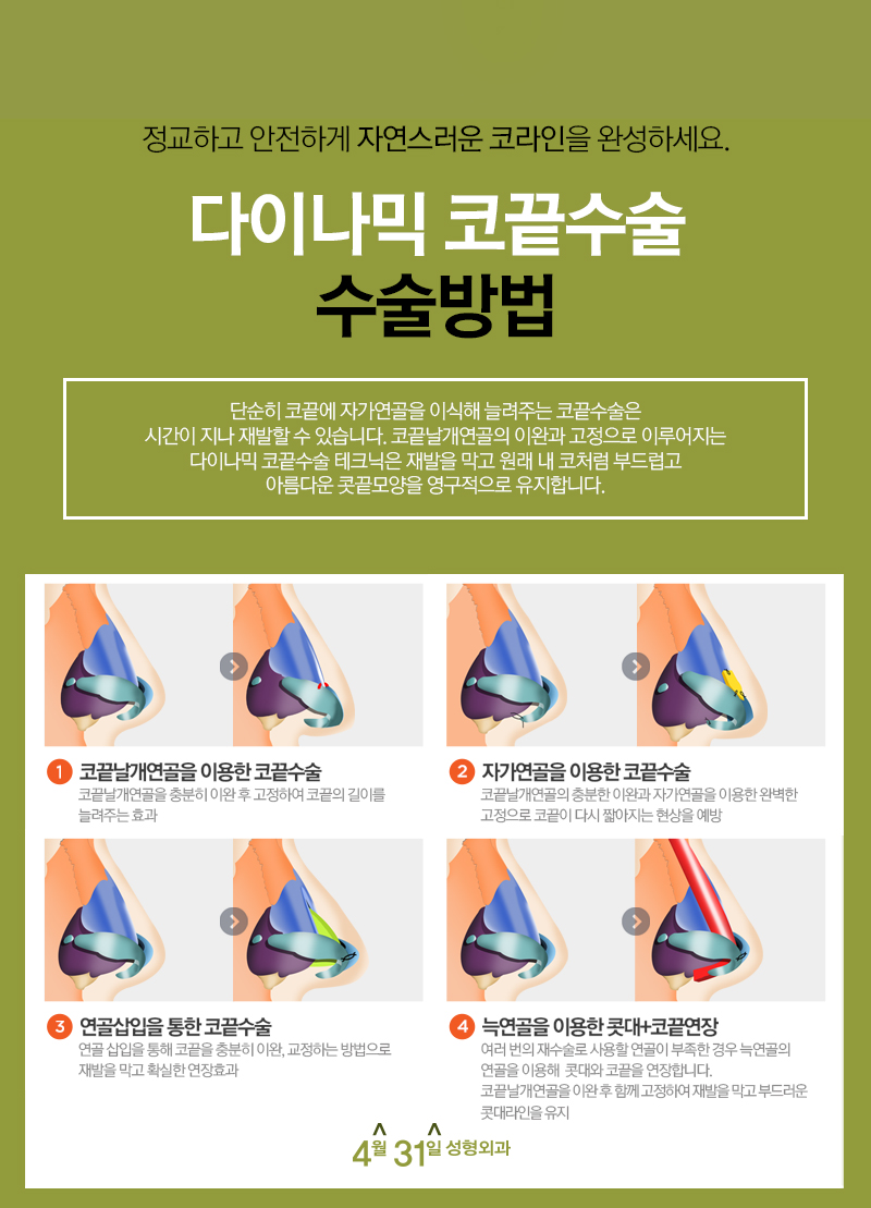 코끝성형잘하는곳 4월31일성형외과의 포인트 관련 이미지 4