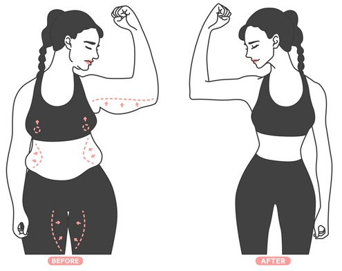 간단한 시술로 슬림탄탄 바디라인 완성!(바디레이저/바디보톡스/라인주사) 관련 이미지 7