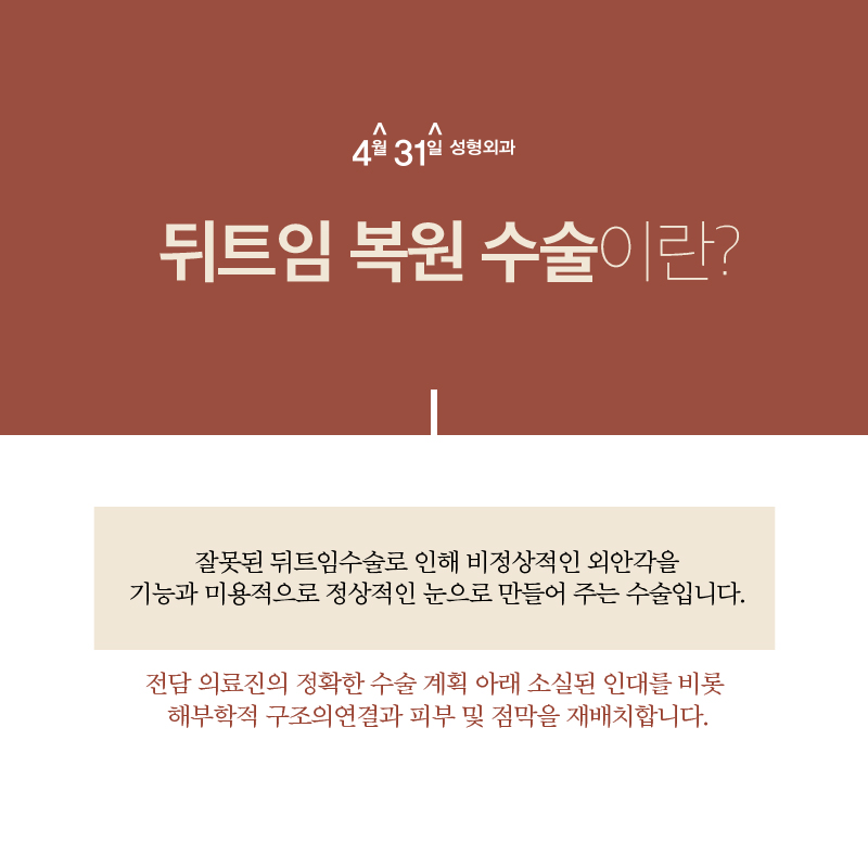 뒤트임복원 더욱 신중하게 관련 이미지 2