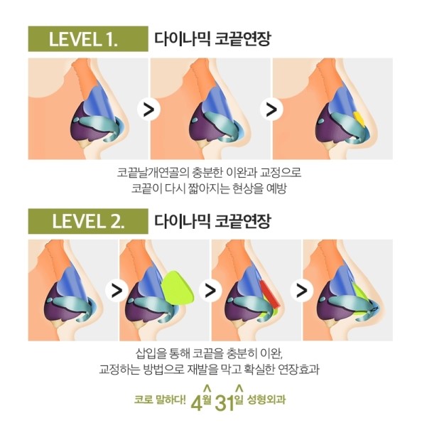강남들창코성형수술 특별하게 4월31일성형외과 관련 이미지 5