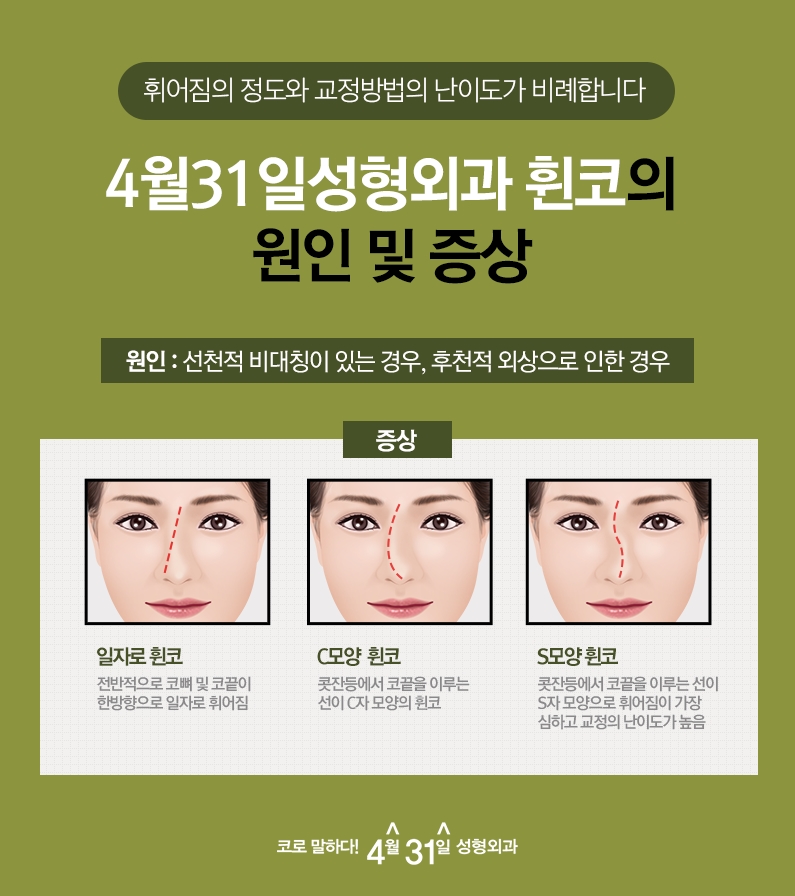 휜코수술효과 4월31일성형외과에서 확인! 관련 이미지 3