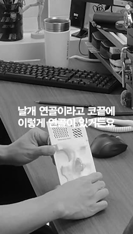 [4월31일성형외과] 코 성형했는데 왜 코끝이 뭉툭해 보일까요? 관련 이미지 4