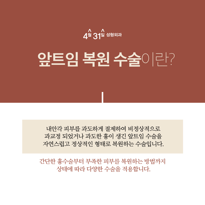 앞트임복원후기 4월31일성형외과로 봤어요 관련 이미지 2