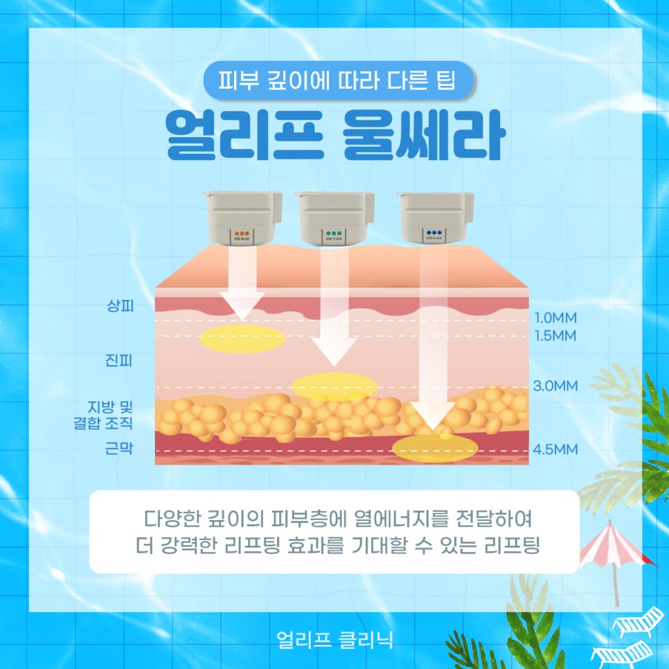 울쎄라의 모든 것(효과, 통증, 정품장비, 정품팁,주의사항 등) 관련 이미지 3