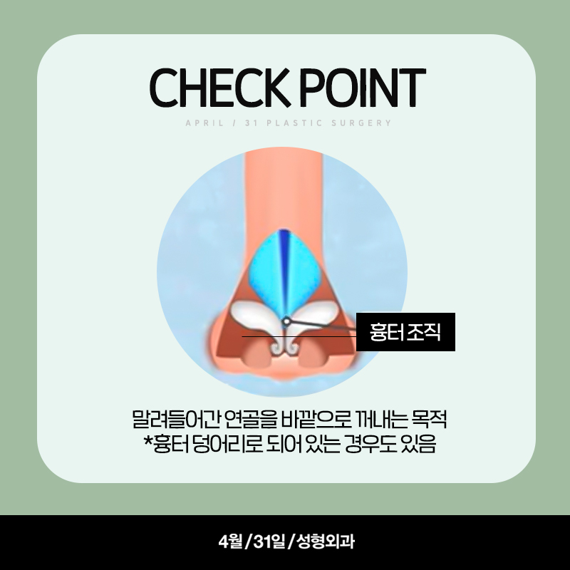[Contracted Nose] Deep Analysis of the 5 Steps of Contracted Nose Correction Part 02_Separation of the Cartilage Structure and Relocation to the Correct Position image 4