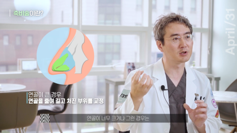 뭉툭한 코, 매부리코를 가지고 있다면 관련 이미지 3