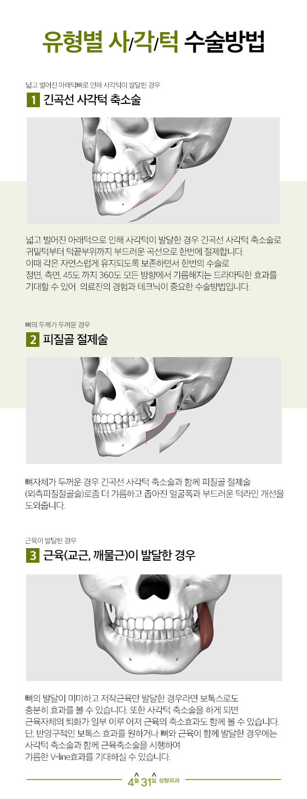 귀뒤사각턱잘하는곳 4월31일성형외과에서 만족도업 관련 이미지 4