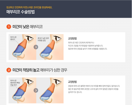매부리코수술잘하는병원 4월31일성형외과의원 추천! 관련 이미지 2
