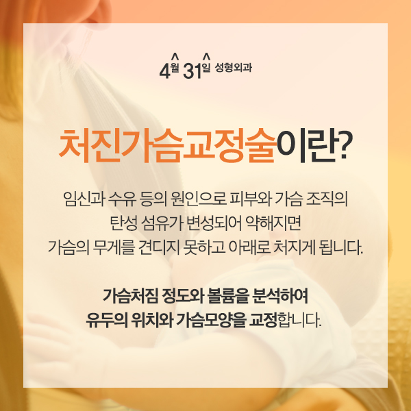 유방하수교정 4월31일성형외과의원 처진가슴수술 관련 이미지 1