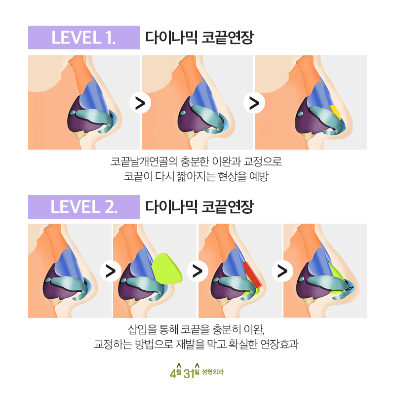 코재수술잘하는병원 4월31일성형외과인 이유? 관련 이미지 4