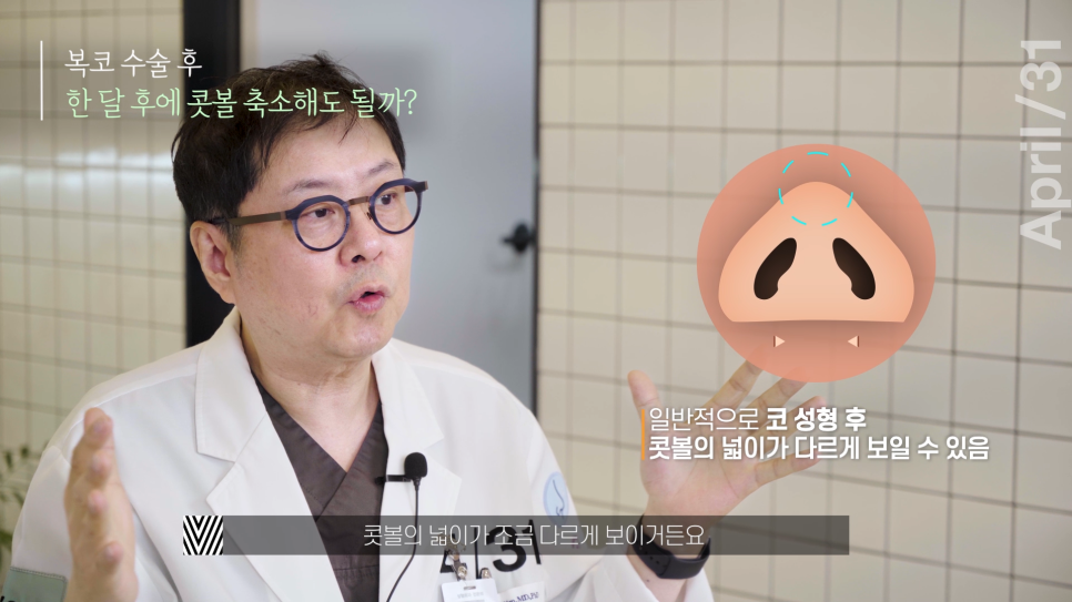 [Nose Surgery] Is It Possible to Reduce a Bulbous Nose with Alar Reduction? Yes or No? image 10