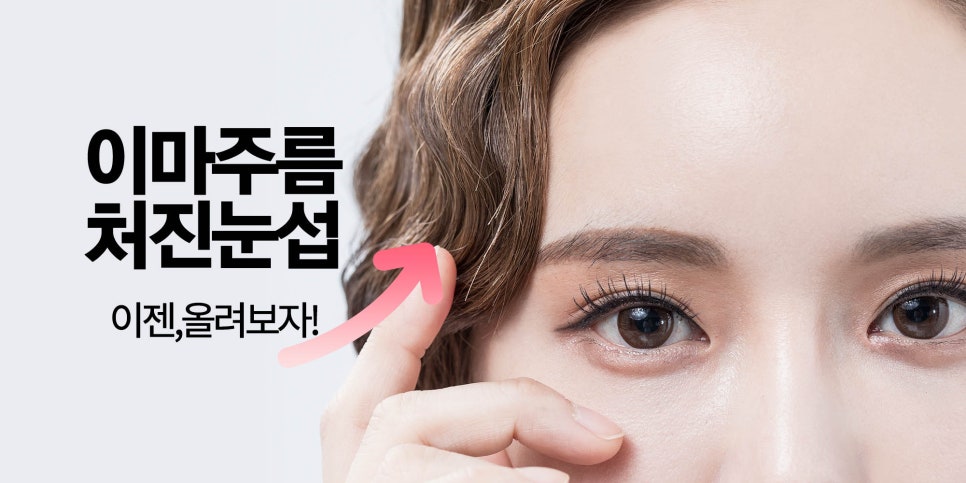 이마거상유명한곳에서 처진 이마, 처진 눈썹 올려보고 동안얼굴 되찾으세요! 관련 이미지 1