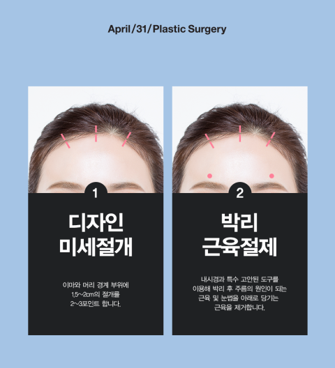 이마거상술잘하는곳에서 안전하게! 어려보이게! 관련 이미지 3