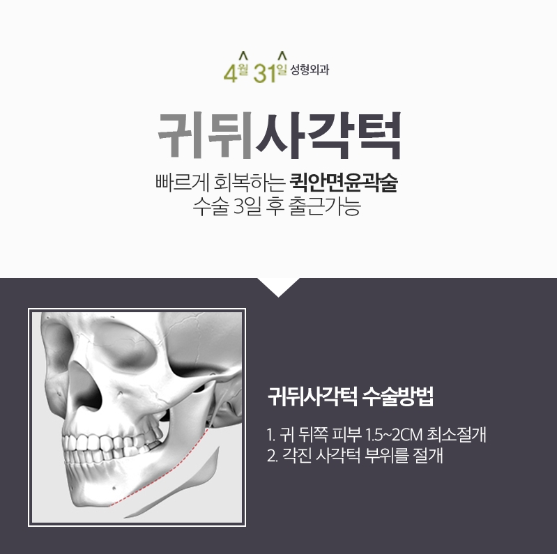 사각턱교정효과 꼼꼼하게 따져봐요 관련 이미지 3