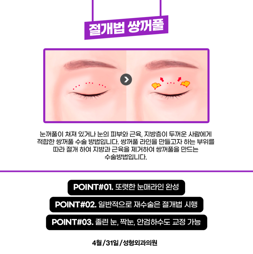 Known as the Place People Visit by Word of Mouth for Eye Surgery Near Gangnam Station image 3