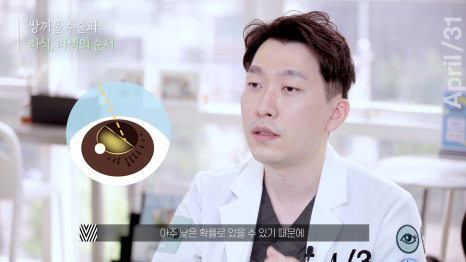 [Eye Surgery] Getting Double Eyelid Surgery Quickly and Discreetly for Vacation! image 13