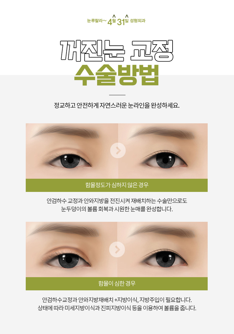 꺼진 눈 교정 지방이식 안전하게 하는 방법 눈꺼풀볼륨업으로!! 관련 이미지 7
