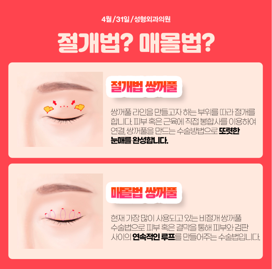 쌍꺼풀수술가격 나에게 어울리도록 관련 이미지 3