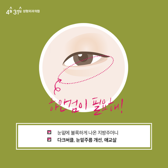 하안검잘하는곳 찾고 있다면 4월31일성형외과의원 관련 이미지 1