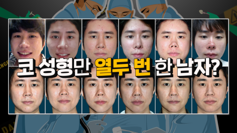 믿을수 있는 구축코재수술 전문 4월31일성형외과 관련 이미지 1