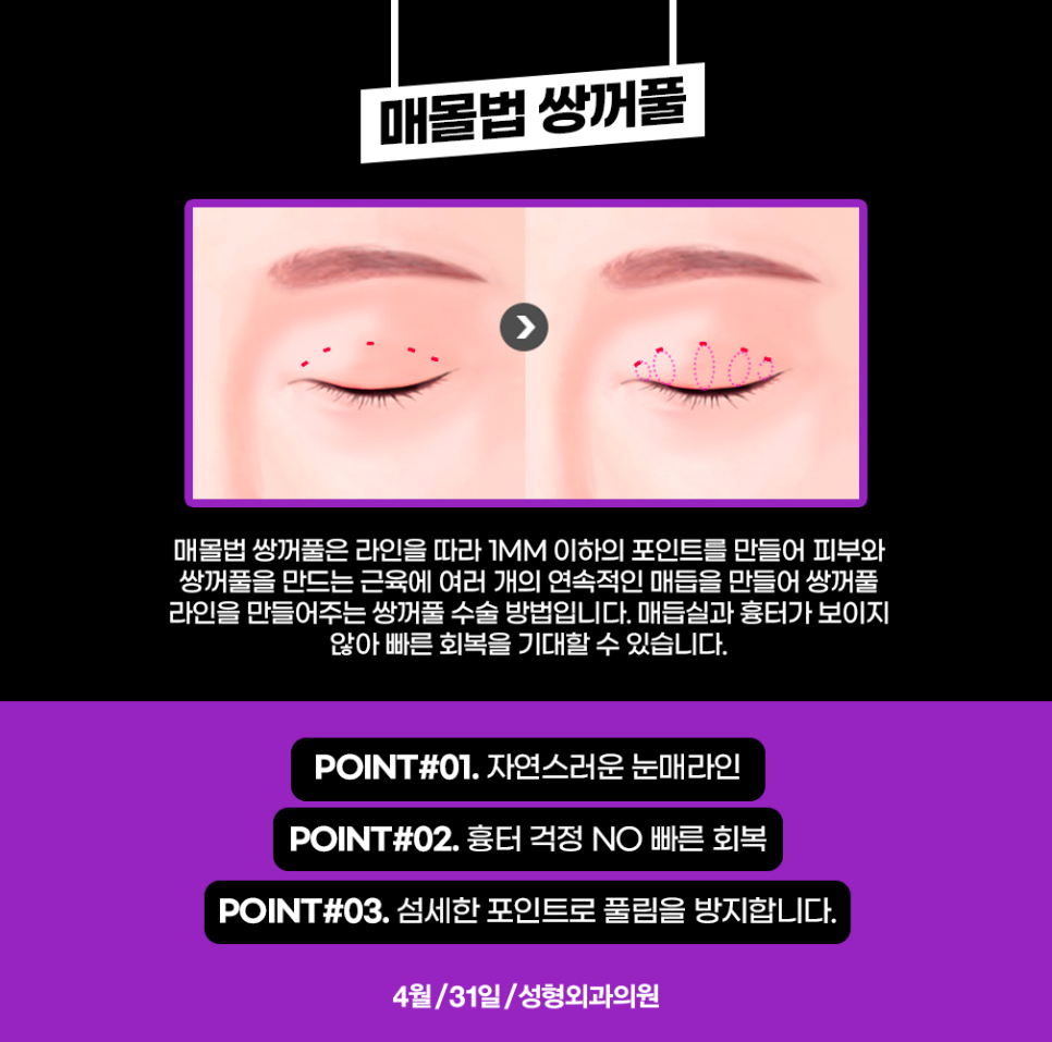 Known as the Place People Visit by Word of Mouth for Eye Surgery Near Gangnam Station image 2