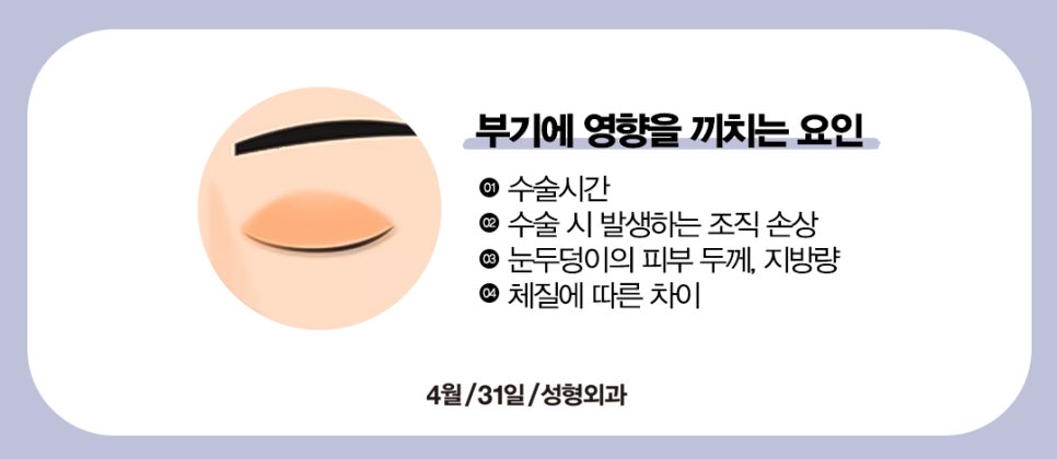 [Eye Surgery] Swelling and Scarring After Double Eyelid Surgery image 2