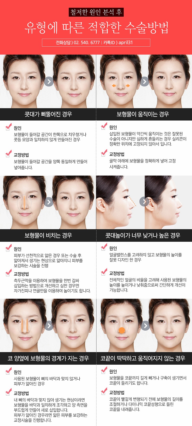 코재수술성형외과 잘하는곳 찾고있나요? 관련 이미지 5
