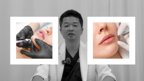[Ultimate Lifting Proje] Top 3 Petit Procedures That Are Good to Do During the Lunar New Year Holiday image 17